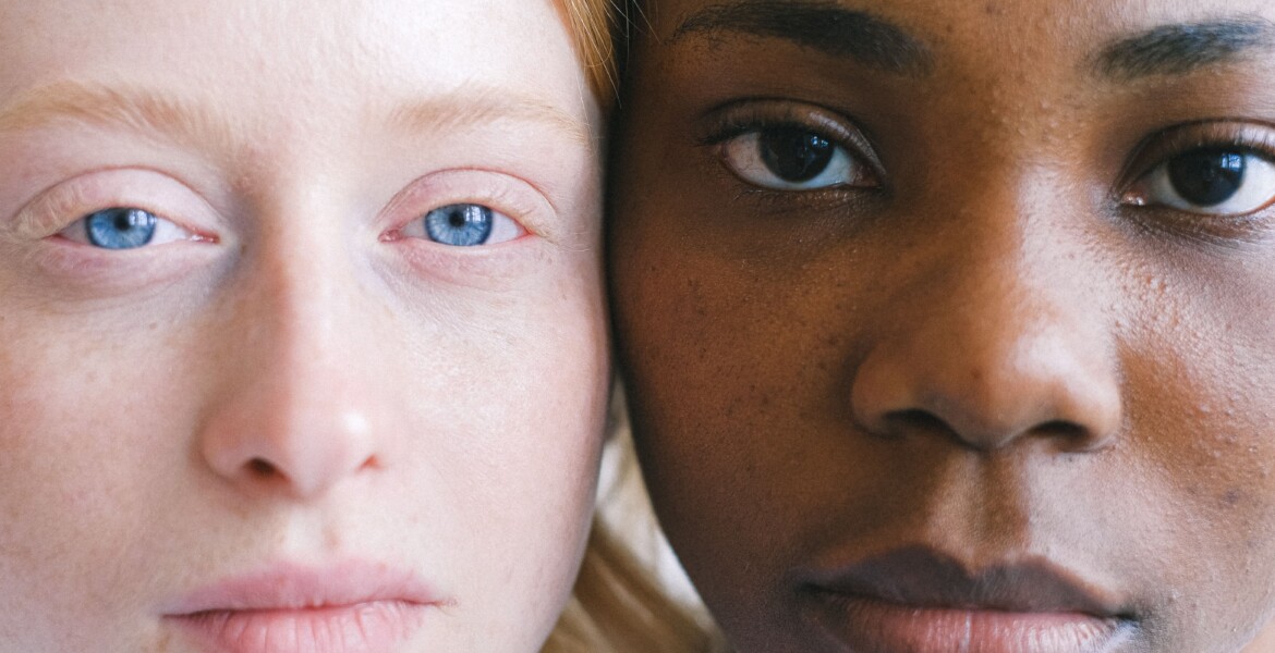 Pelle mista: come riconoscerla e scegliere la skincare più efficace