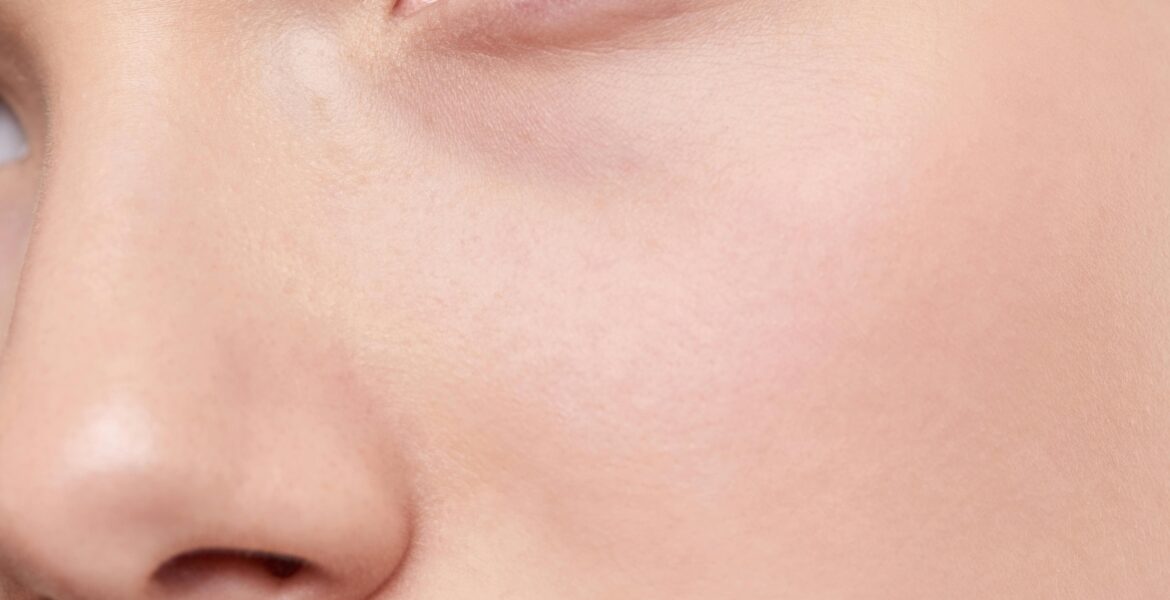 Skin Barrier Reset: strategia per riparare la barriera cutanea in 7 giorni